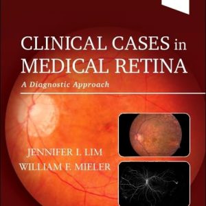 Clinical Cases in Medical Retina: A Diagnostic Approach 1st Edition