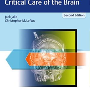 Neurotrauma and Critical Care of the Brain 2nd Edition