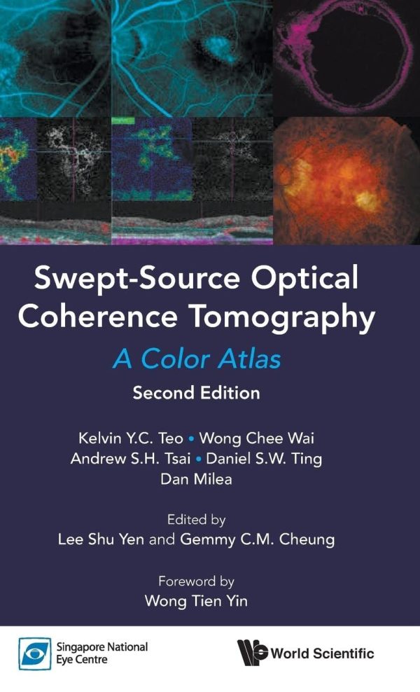 SWEPT-SOURCE OPTICAL COHERENCE TOMOGRAPHY: A COLOR ATLAS (SECOND EDITION) 2nd Edition