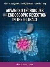 Advanced Techniques for Endoscopic Resection in the GI Tract First Edition