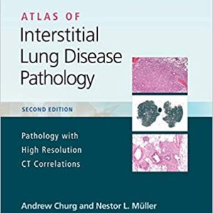 Atlas of Interstitial Lung Disease Pathology 2nd Edition