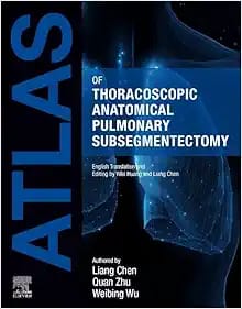 Atlas of Thoracoscopic Anatomical Pulmonary Subsegmentectomy 1st Edition