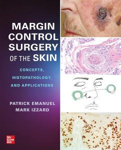 Margin Control Surgery of the Skin: Concepts, Histopathology, and Applications 1st Edition