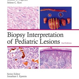 Biopsy Interpretation of Pediatric Lesions Second Edition