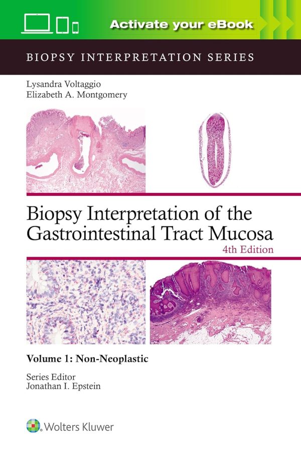 Biopsy Interpretation of the Gastrointestinal Tract Mucosa Volume 1: Non-Neoplastic 4th Edition