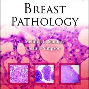 Breast Pathology (Consultant Pathology Book 6) 1st Edition