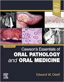 Cawson’s Essentials of Oral Pathology and Oral Medicine 10th Edition