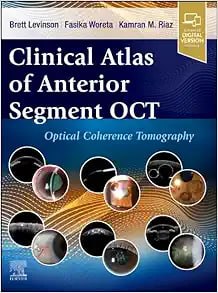 Clinical Atlas of Anterior Segment OCT: Optical Coherence Tomography First Edition