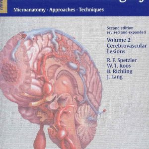 Color Atlas of Microneurosurgery  Volume 2 – Cerebrovascular Lesions Microanatomy  Approaches Techniques  Second Edition