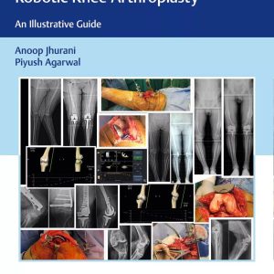 Computer Navigated and Handheld Robotic Knee Arthroplasty  An Illustrative Guide First Edition