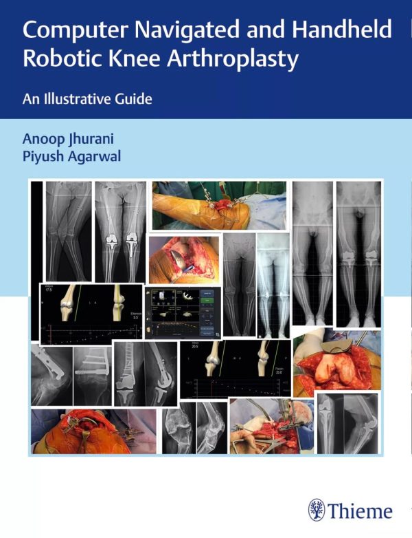 Computer Navigated and Handheld Robotic Knee Arthroplasty  An Illustrative Guide First Edition