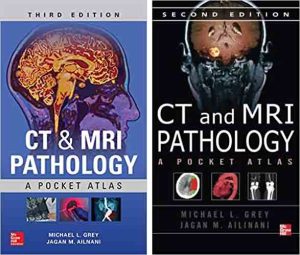CT & MRI Pathology: A Pocket Atlas, Third Edition