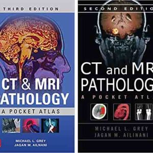 CT & MRI Pathology: A Pocket Atlas, Third Edition