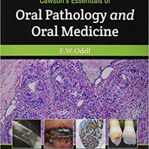 Cawson’s Essentials of Oral Pathology and Oral Medicine 9th Edition