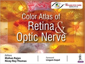 Color Atlas of Retina and Optic Nerve 1st Edition,