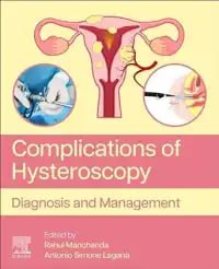 Complications of Hysteroscopy Diagnosis and Management First Edition