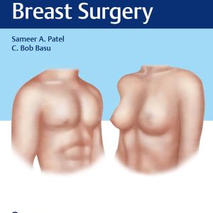 Cosmetic Breast Surgery 1st Edition