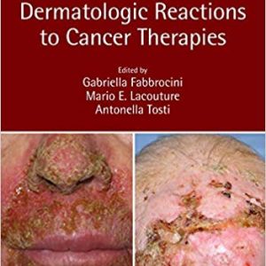 Dermatologic Reactions to Cancer Therapies 1st Edition