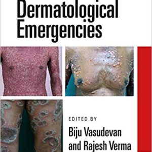 Dermatological Emergencies 1st Edition