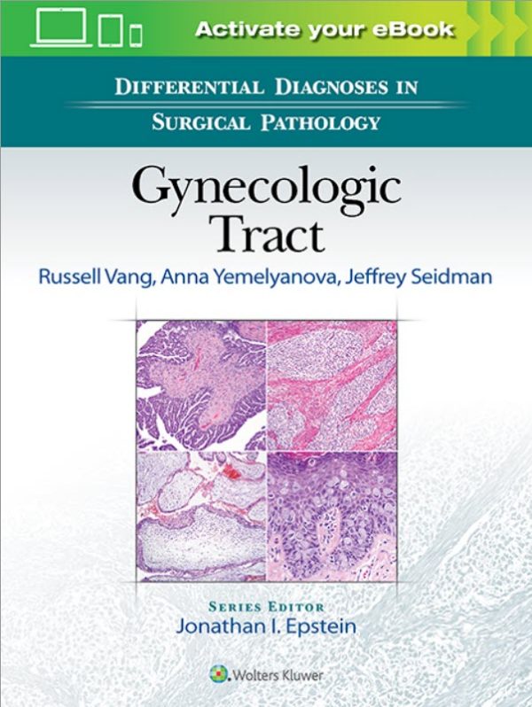 Differential Diagnoses in Surgical Pathology: Gynecologic Tract Second Edition