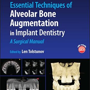 Essential Techniques of Alveolar Bone Augmentation in Implant Dentistry: A Surgical Manual Second Edition