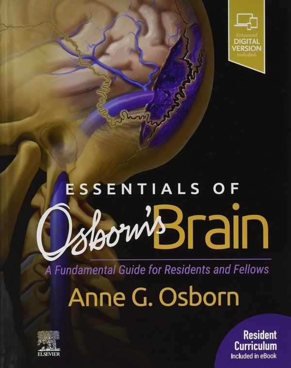 Essentials of Osborn’s Brain: A Fundamental Guide for Residents and Fellows 1st Edition