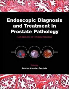 Endoscopic Diagnosis and Treatment in Prostate Pathology: Handbook of Endourology 1st Edition