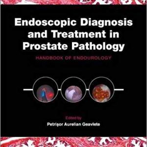 Endoscopic Diagnosis and Treatment in Prostate Pathology: Handbook of Endourology 1st Edition