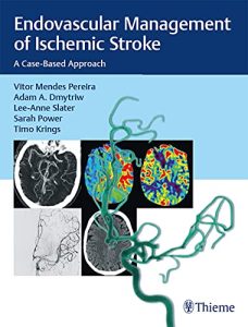 Endovascular Management of Ischemic Stroke: A Case-Based Approach