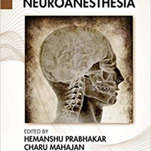 Essentials of Geriatric Neuroanesthesia 1st Edition