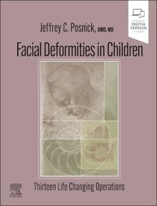 Facial Deformities in Children: Thirteen Life Changing Operations 1st Edition