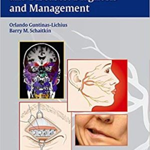 Facial Nerve Disorders and Diseases: Diagnosis and Management 1st Edition