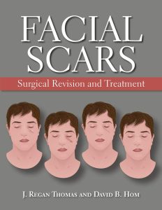 Facial Scars: Surgical Revision and Treatment (June 25, 2019)