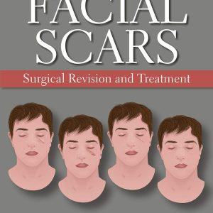 Facial Scars: Surgical Revision and Treatment  (June 25, 2019)