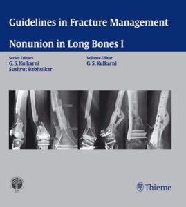 Guidelines in Fracture Management – Nonunion in Long Bones I