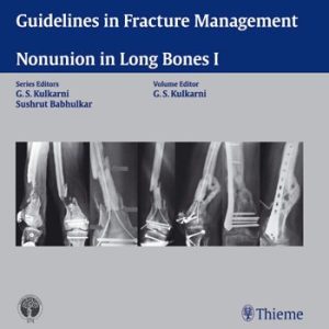 Guidelines in Fracture Management – Nonunion in Long Bones I