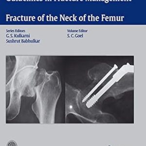 Guidelines in Fracture Management- Fracture of the Neck of the Femur