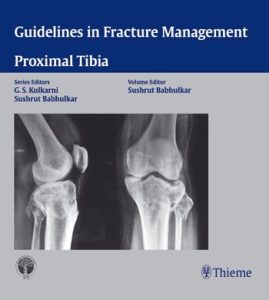 Guidelines in Fracture Management – Proximal Tibia