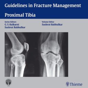 Guidelines in Fracture Management – Proximal Tibia