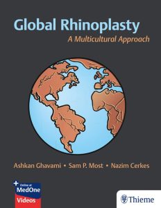 Global Rhinoplasty: A Multicultural Approach 1st Edition