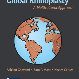 Global Rhinoplasty: A Multicultural Approach 1st Edition