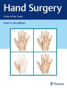 Hand Surgery: Tricks of the Trade 1st Edition