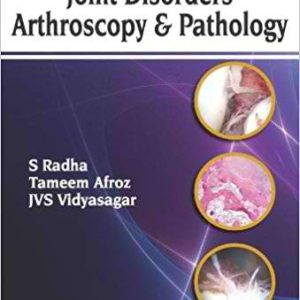 Handbook of Joint Disorders Arthroscopy and Pathology 1st Edition