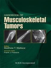 Handbook of Musculoskeletal Tumors First Edition