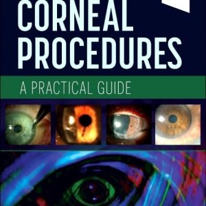 In-Office Corneal Procedures: A Practical Guide 1st Edition