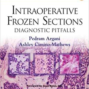 Intraoperative Frozen Sections: Diagnostic Pitfalls (Consultant Pathology, Volume 5) 1st Edition