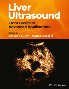 Liver Ultrasound From Basics to Advanced Applications First Edition