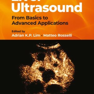 Liver Ultrasound From Basics to Advanced Applications  First Edition