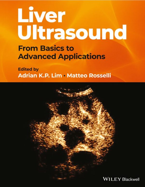 Liver Ultrasound From Basics to Advanced Applications  First Edition