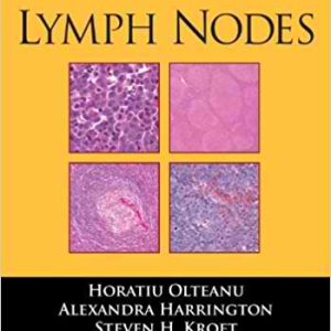 Lymph Nodes (Demos Surgical Pathology Guides) 1st Edition